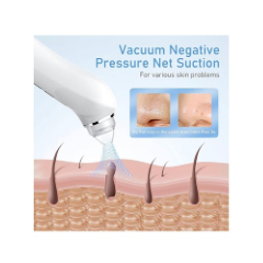 VACUUM BLACKHEAD REMOVER (HD CAMERA)